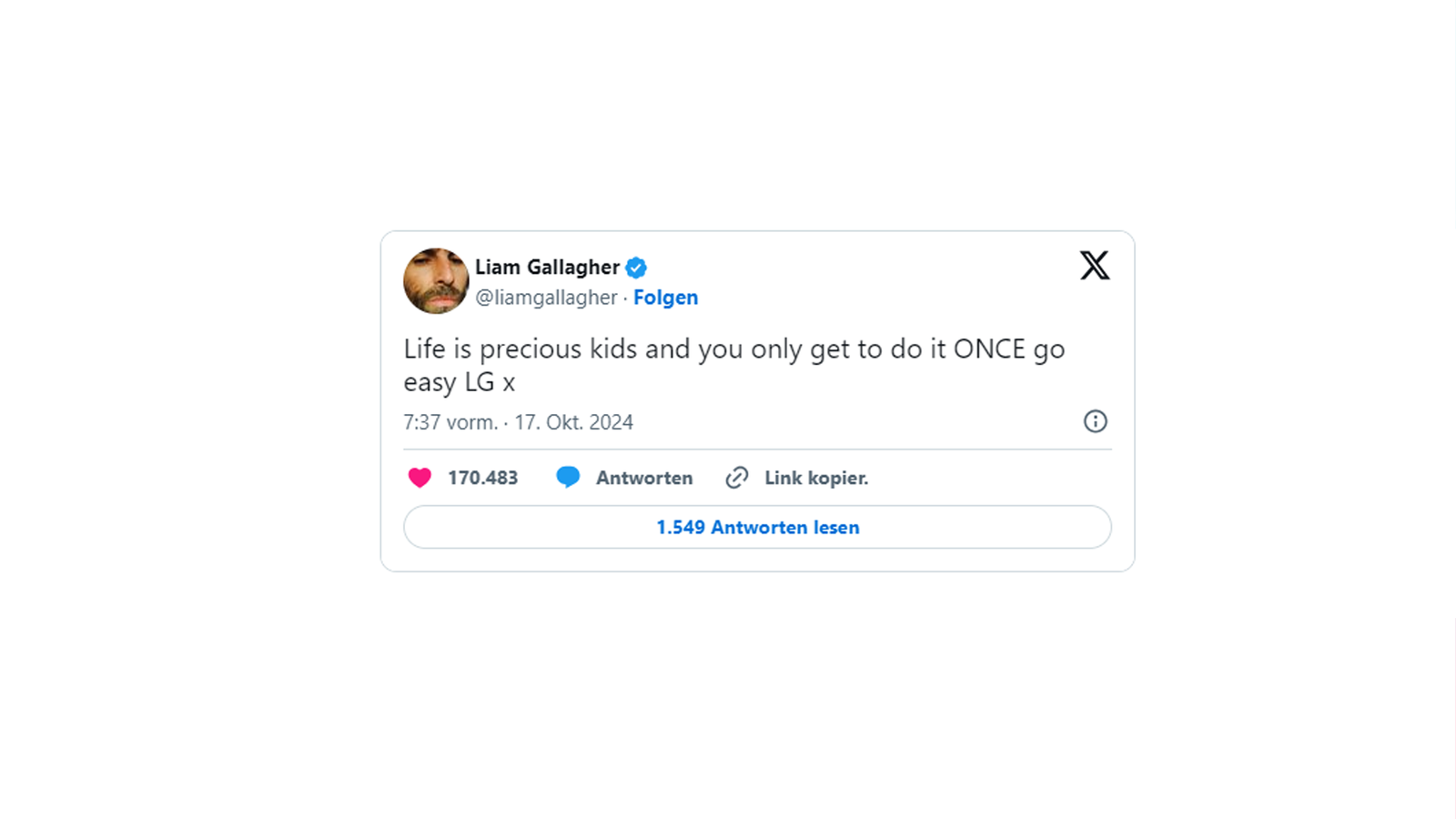 Post von Liam Gallagher auf X